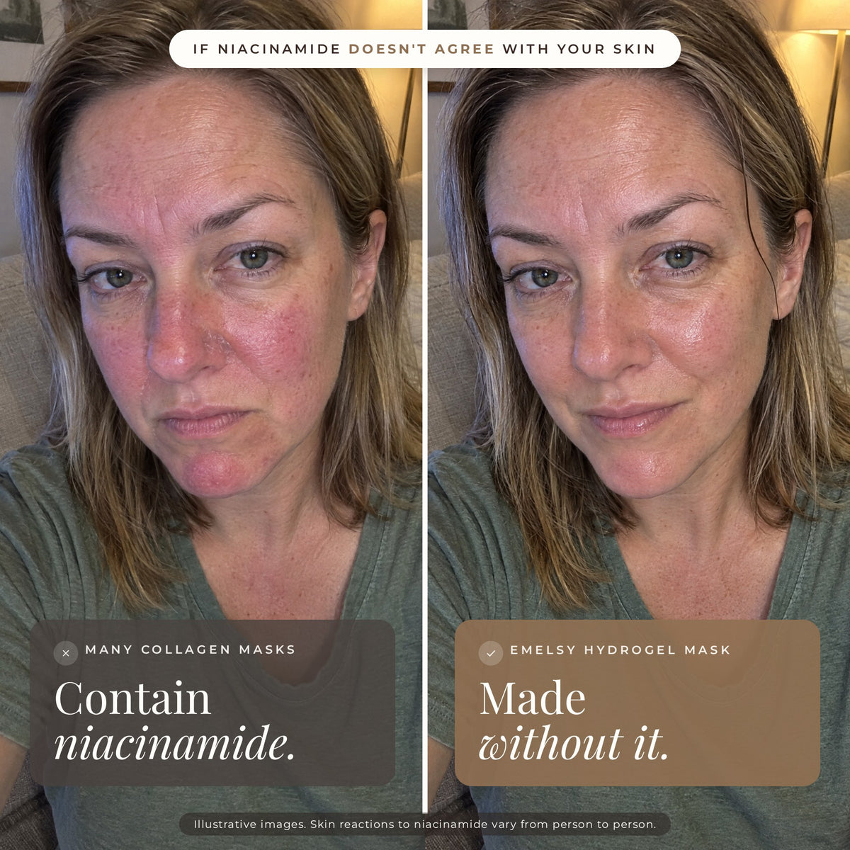 Comparison: many collagen masks contain niacinamide, Emelsy hydrogel mask is made without it